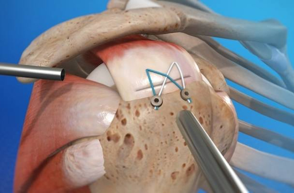 Diz ve Omuz Artroskopisi